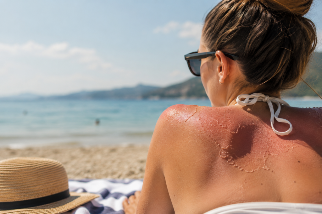 Sommer Hautpflegetipps: 7 Tipps für heiße Tage